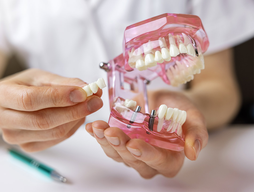 Zahnärztliche Chirurgie & Implantologie am Helene-Weigel-Platz 1